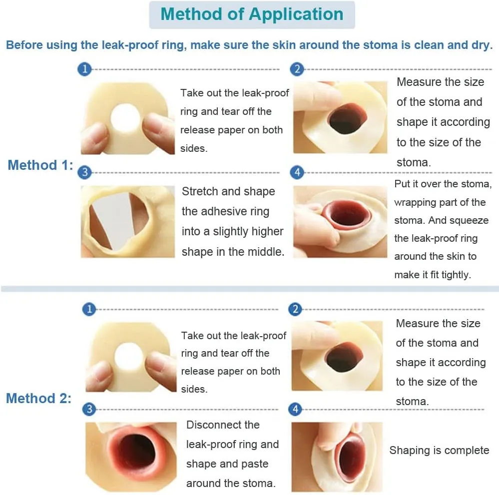 Ostomy Barrier Rings No Leaking Barrier Extenders for Colostomy Bags Pack of 10